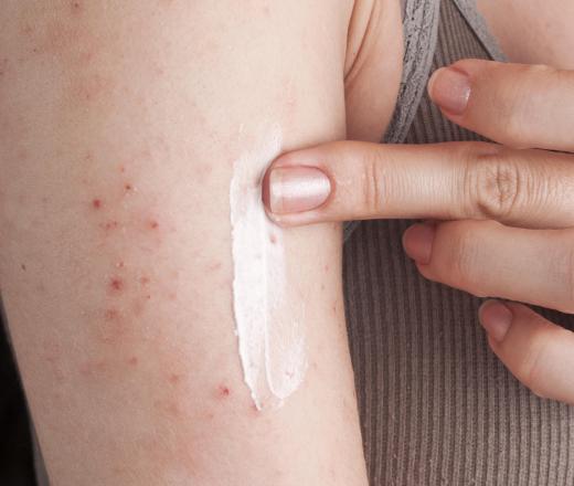 Oil solvents may become absorbed into the skin, causing an itchy rash.