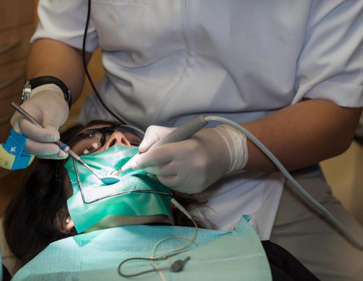 Dentists use ultrasonic cleaning tools.