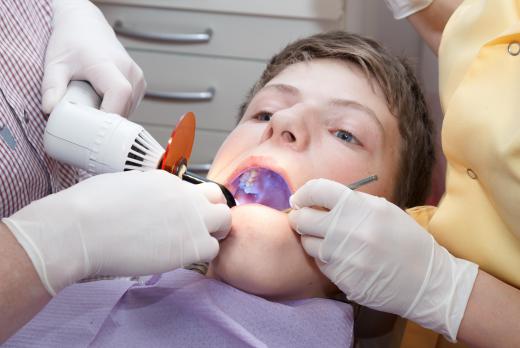 Dentist using UV light to cure, or harden, resin.